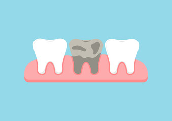 Teeth in gum with dead decay tooth dentistry sign isolated on blue background. Tooth row in jaw flat design cartoon style vector dental health, treatment and lost prevention concept illustration.