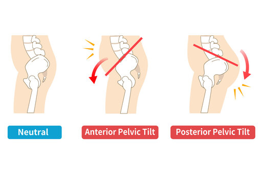 Relationship between pelvic tilt and posture..
