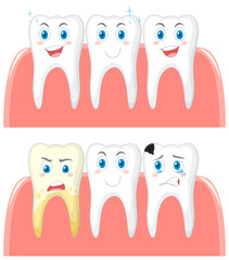 Set of strong teeth and tooth decay on white background