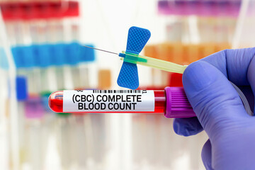 doctor with Blood tube and needle for general CBC Complete Blood Count test in lab. Blood sample of...