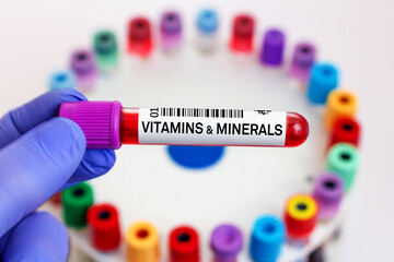 doctor with Blood tube for Vitamins & minerals test in lab. Blood sample of patient for Vitamins...