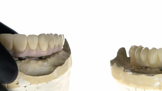 Dental orthopedist in black gloves shows prostheses of the lower and upper jaws from zircon on titanium beams on a white background