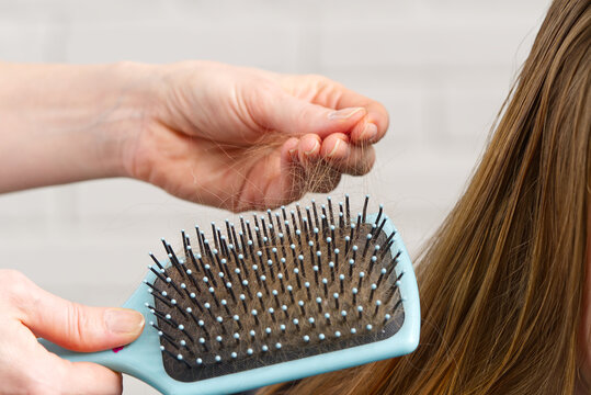 Hair Stuck On A Comb, Blurred Background. Hair Brush With Damaged Hair. Hair Loss Problem. Bad Hair Falling Out