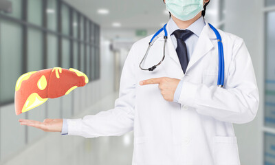 doctor showing fatty liver - obrazy, fototapety, plakaty