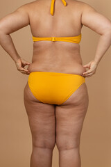 Cropped vertical photo overweight fat woman back with obesity, excess fat yellow swimsuit. Big size. Holding waist flabs, visceral, cellulite. Varicose veins, imperfection skin puffy body. Liposuction