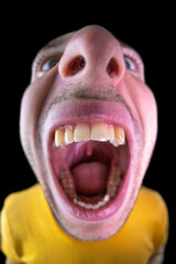 Man with wide open mouth