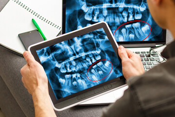 Fototapeta na wymiar Dentist Office-Digital tablet with a patients x-rays