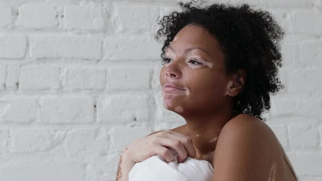 Portrait of thoughtful afro woman with vitiligo hugging pillow