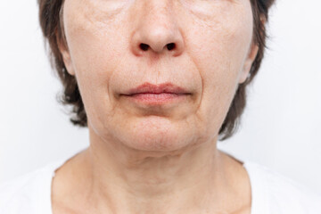 Obraz premium The lower part of elderly woman's face and neck with signs of skin aging isolated on a white background. Age-related changes, flabby sagging facial skin, wrinkles and creases. Cosmetology and beauty