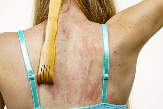 Woman scratching her itchy back using scratcher