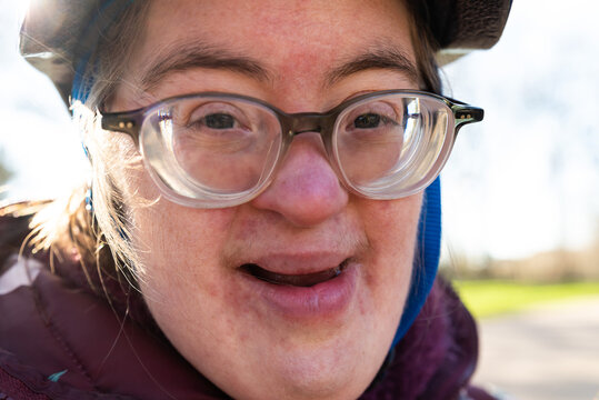 Outdoor Portrait Of A 39 Year Old White Woman With The Down Syndrome