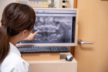 レントゲン写真を確認する歯科衛生士
