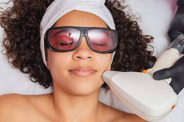 Brazilian black woman performing laser hair removal on upper lip
