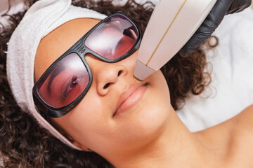 Closeup photo of Black Brazilian woman performing laser hair removal on upper lip