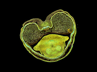 cross section cut slice of plant stem under the microscope – microscopic view of plant cells for...