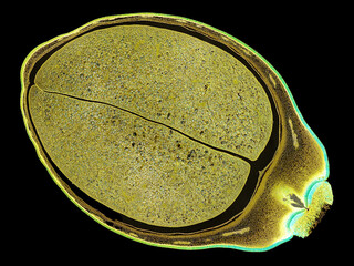 cross section cut slice of plant stem under the microscope – microscopic view of plant cells for...