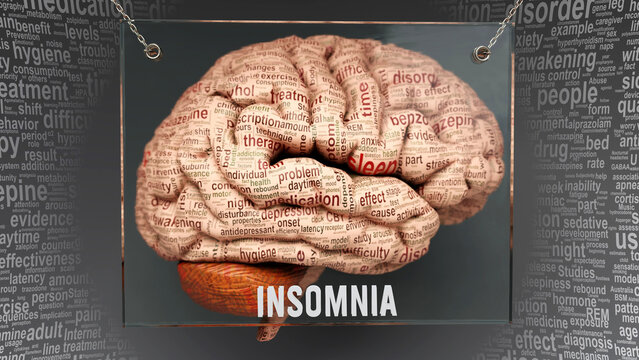 Insomnia anatomy - its causes and effects projected on a human brain revealing Insomnia complexity and relation to human mind. Concept art, 3d illustration