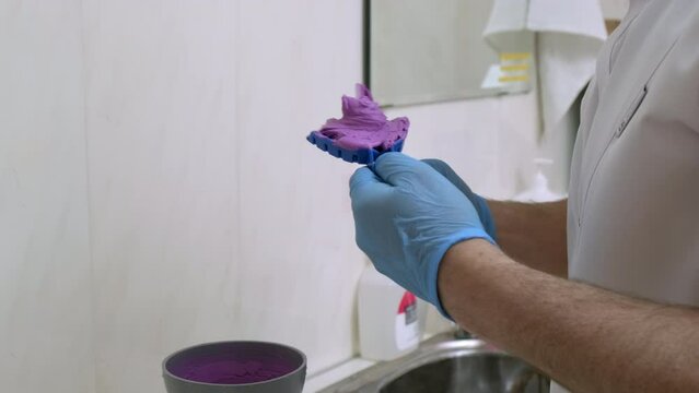 Doctor dentist in gloves holds a fingerprint for denture purple. Dental staff mix alginate for dental impression to make teeth working model. Healthcare and dentistry business