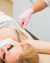 Laser hair removal in the armpit of a woman - smooth clean skin without hair