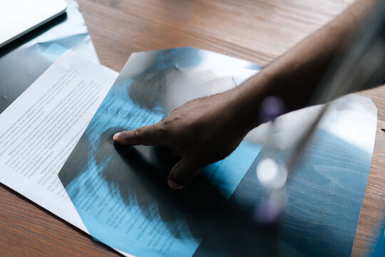 Close-up hand of unrecognizable African-American doctor pointing with index finger at radiograph x-ray image of lungs. Closeup of qualified medical worker making diagnostic and analysis for patient.
