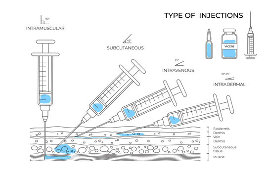 Types of injections. Guide to injecting vaccines into skin. Medical procedure manuals for hospital workers. Set vector illustration
