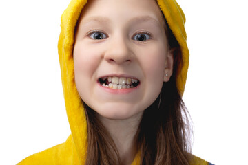 Cute little girl 10 years old posing in yellow pajamas. The child shows yellow plaque on the teeth.