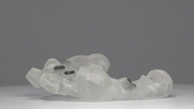 dental surgical template for implantation of four implants on the site with rotation