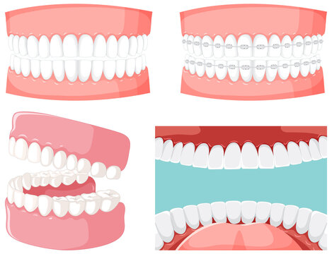 Set Of Teeth Inside Human Mouth With Human Teeth Model