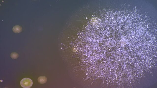 Timelapse of the growth of bacteria and microorganisms in a petri dish on agar.