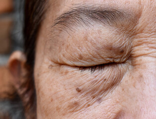 Wrinkles around closed eye of Asian elder woman.