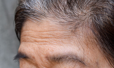 Skin creases or wrinkles at oily forehead of Southeast Asian, Myanmar or Burmese elder woman....
