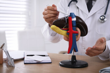 Doctor demonstrating model of liver at table in clinic, closeup