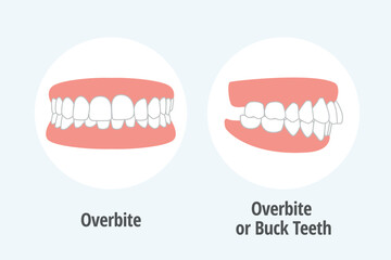 icon dental problem. vectorial illustration Overbite