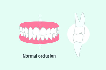 icon dental problem. vectorial illustration normal occlusion