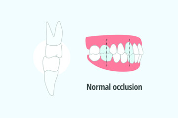 icon dental problem. vectorial illustration Normal occlusion