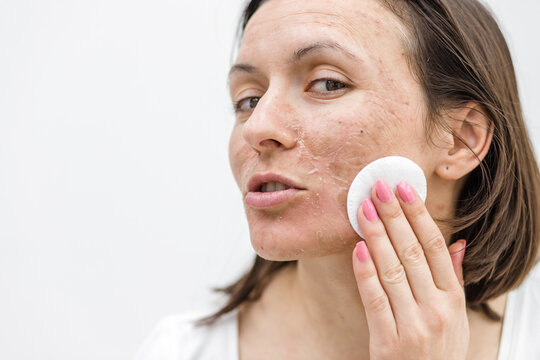 Close up photo of woman cleaning face with cosmetic sponge.