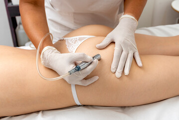 young woman in a beauty and spa center performing a beauty treatment for body and skin care with a diamond tip technique and dermapen for stretch marks