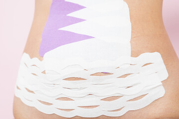 Young woman with kinesio tape on her belly. Kinesio taping for lifting a flabby abdomen. Weight loss concept.