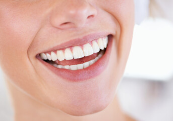 A brilliant display of pearly whites. Close up of a womans sparkling teeth.