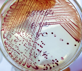 Bacteria colony of Escherichia coli (E.coli) in culture media plate.
