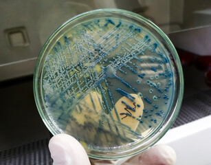Bacteria culture growth on a petri dish in microbiology lab.