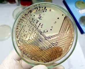 Bacteria colony of Escherichia coli (E.coli) in culture media plate.