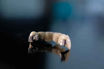 Dental ceramic bridge on isolated wite background. Metal free ceramic dental crowns