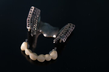 Metal Free Ceramic Dental Crowns. Ceramic zirconium in final version. Staining and glazing. Precision design and high quality materials.