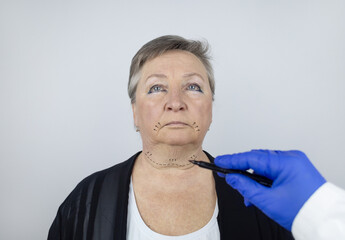 An elderly woman at the reception of a facial plastic surgeon. Consultation on the removal of age...
