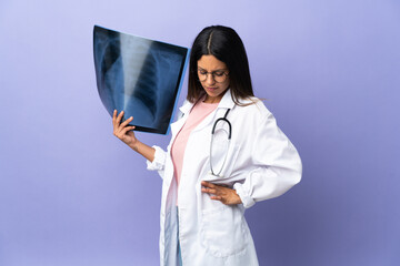 Young doctor woman holding a radiography suffering from backache for having made an effort