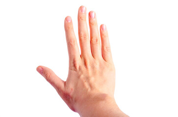 skin irritation on right wrist dermatitis