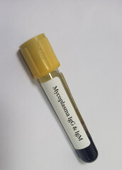 Blood sample for Mycoplasma IgG and IgM test to diagnosis mycoplasma infection.