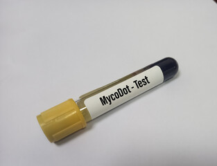 Blood sample for MycoDot test for diagnosis of tuberculosis(TB) among HIV seronegative than HIV seropositive patients. White background, copy space.