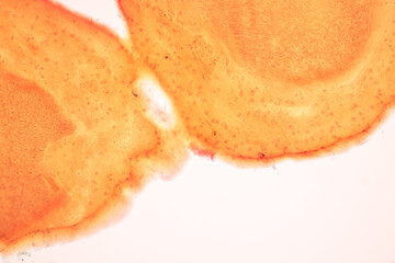 Tooth development from human under microscope view for education.
